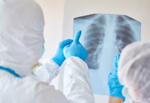 pneumonia in COVID-19 patients