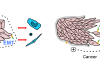 Left, intact epithelium is a continuous sheet with an electrical potential across it, and signal molecules produced on one side (green) that cannot reach receptors (yellow) on the other side. A basement membrane (grey) separates epithelium from other cells. When the sheet is broken, as in a wound, cells change shape (‘EMT’) and send signals that include electric currents and interaction between signal molecules and receptors. The basement membrane may be breached, bringing epithelial cells in contact with other cells. Defence and repair cells (blue) respond. Right, in cancers, the epithelial sheet is disrupted, activating the same wound-healing changes.